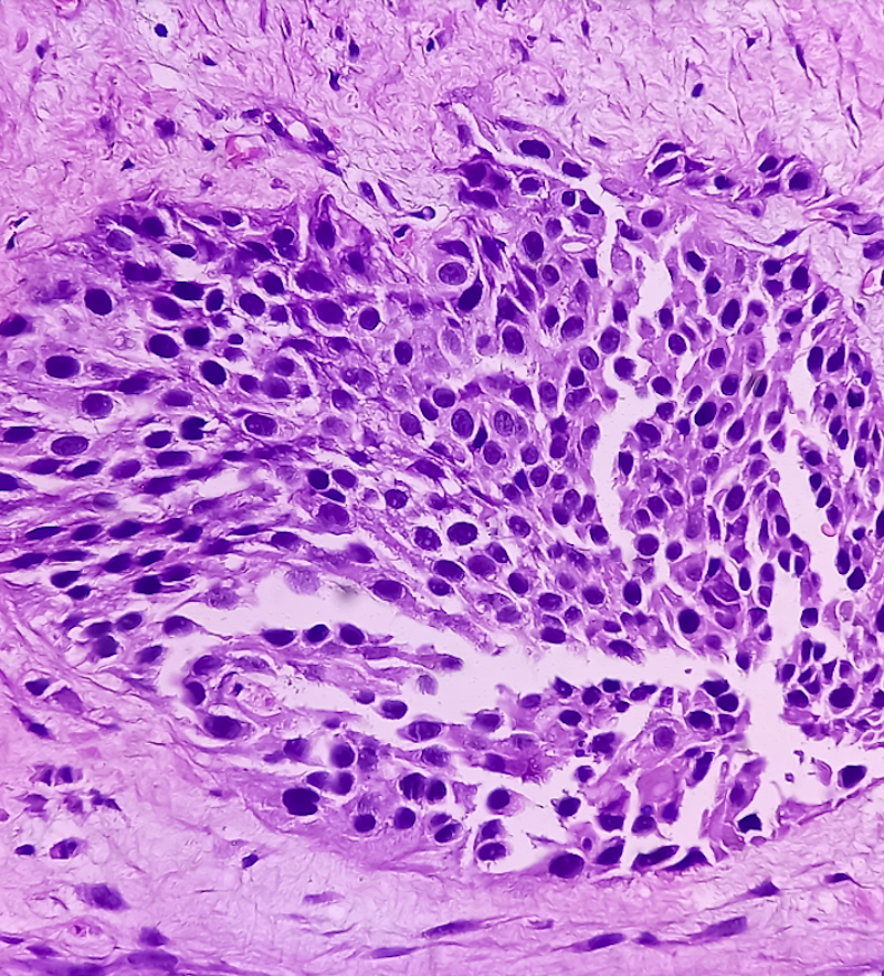 Canine Transitional Cell Carcinoma: Diagnosis and Management