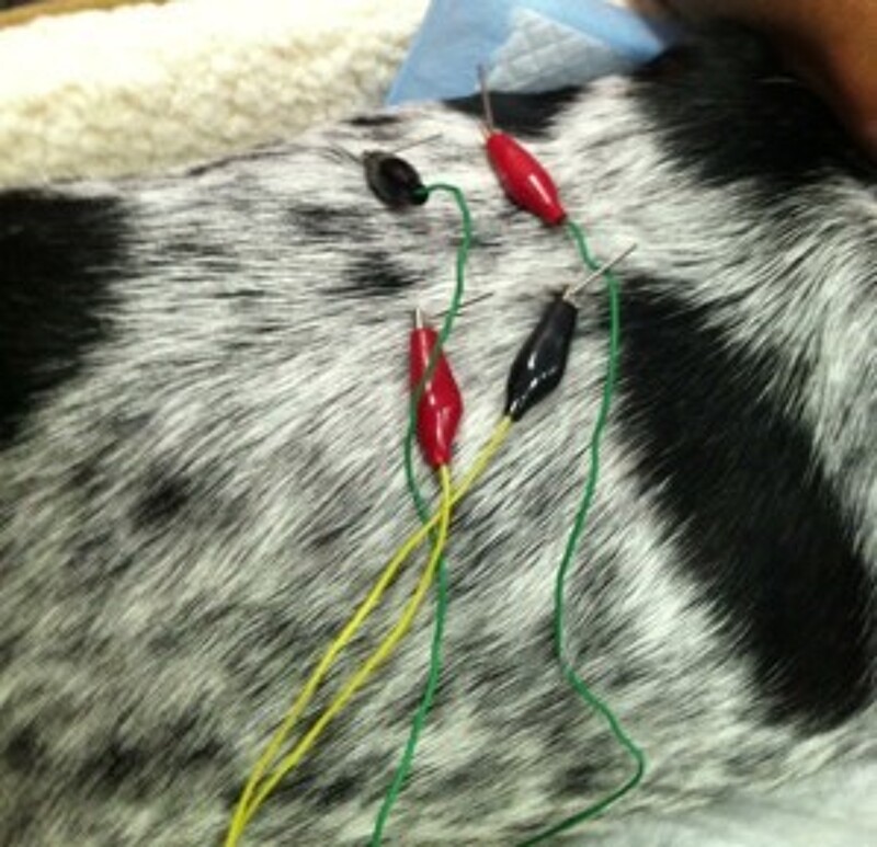 Demystifying Electroacupuncture
