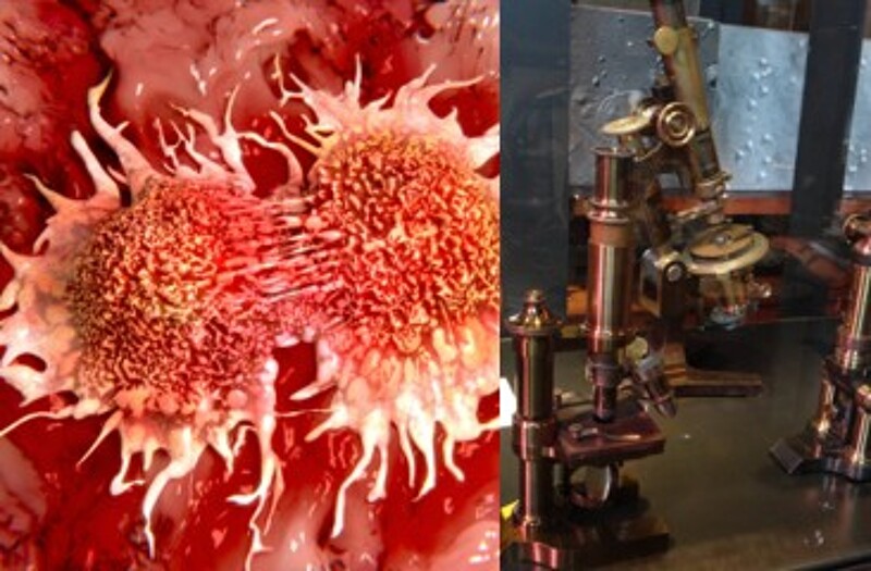 Revisiting the Warberg Hypothesis and Rife's Microscope - Two Interesting Anti-Cancer Therapies 